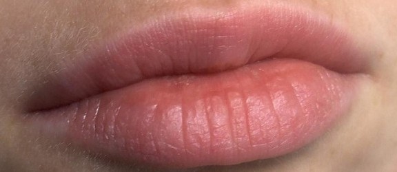 Jak zadbać o pękające usta? Odpowiada Marzena Gross - Darabasz